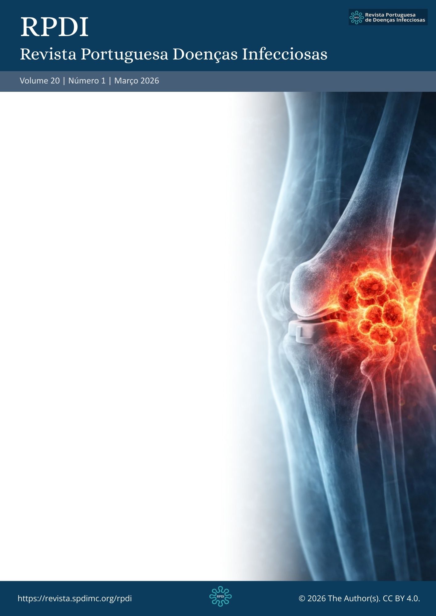 					Ver Vol. 20 N.º 1 (2026): Revista Portuguesa de Doenças Infecciosas
				